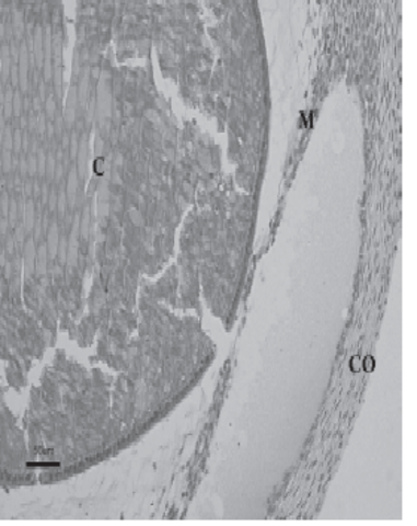 Desarrollo del iris y cuerpo ciliar
