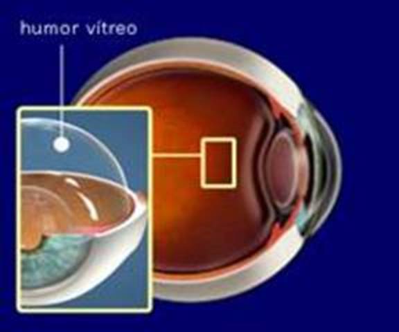 CUERPO VITREO