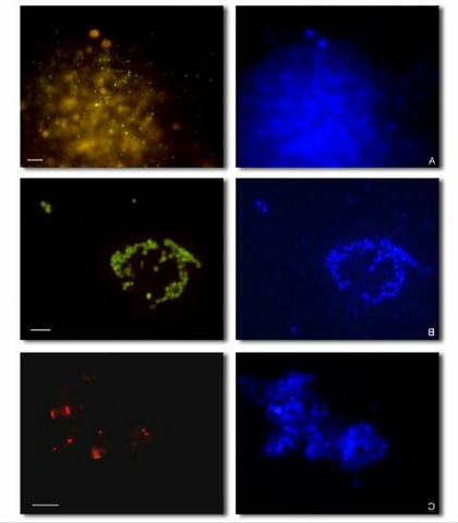 Bacterias quimiolitótrofas