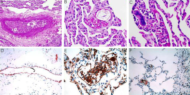 Inicio de la Patología celular