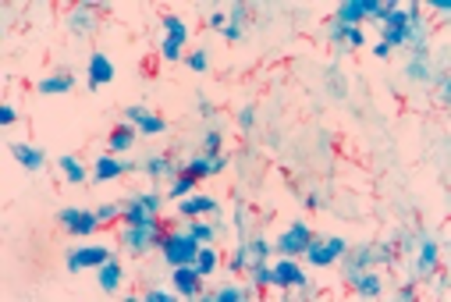 Se descubre el Mycobacterium tuberculosis