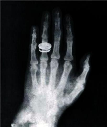 Wilhelm Röntgen (1845 - 1923, Pruciano)