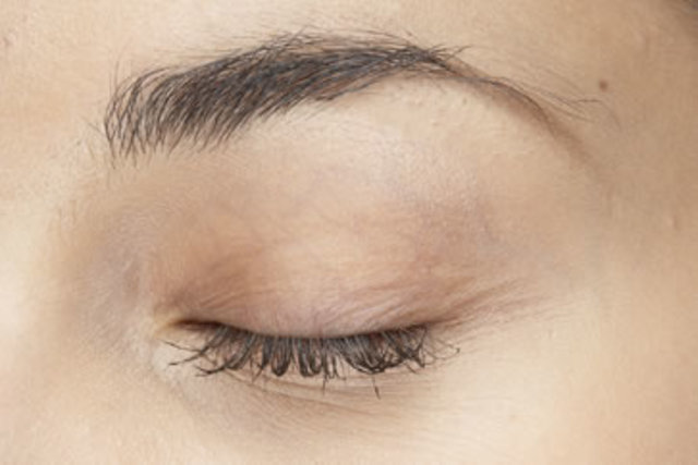 Párpados (A las seis semanas)