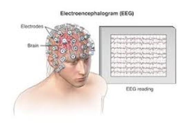 Origen de la electroencefalografía