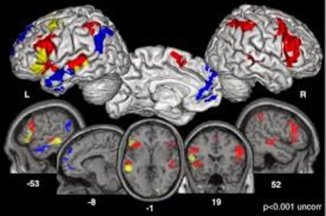Resonancia Magnética Funcional