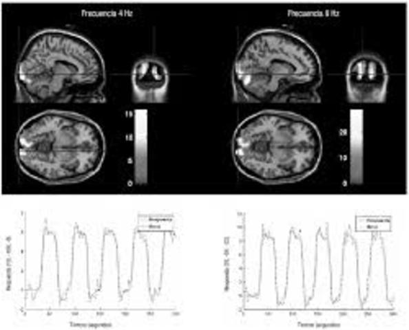 Neuroimagenología y la Neurofisiología moderna