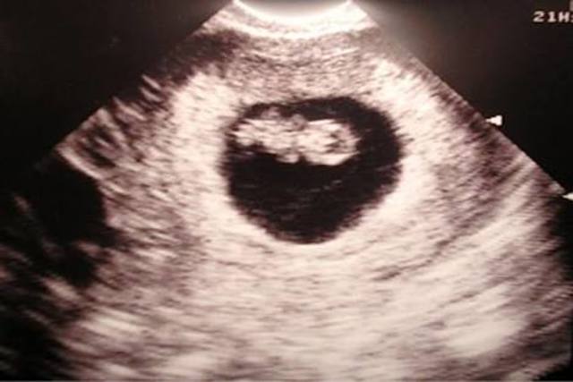 Se comienzan a realizar los primeros ultrasonidos con fines médicos.