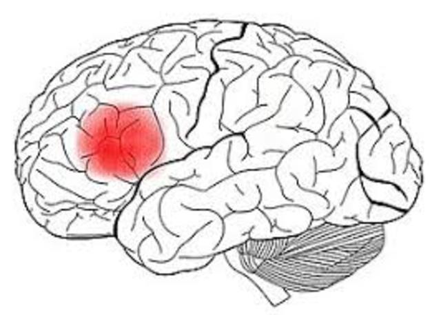 Área cerebral del lenguaje