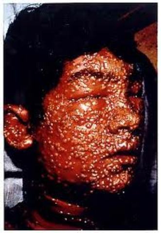 Smallpox Epidemic