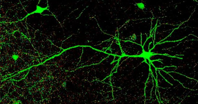 EDAD CONTEMPORÁNEA- El Primer Hallazgo De La Proteína Verde Fluorescentes