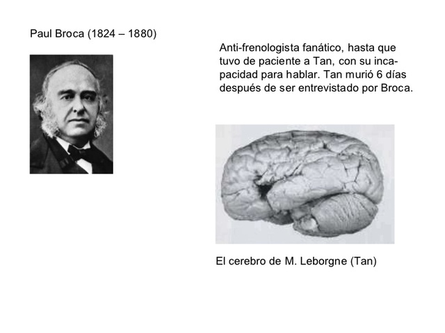 “área de Broca”