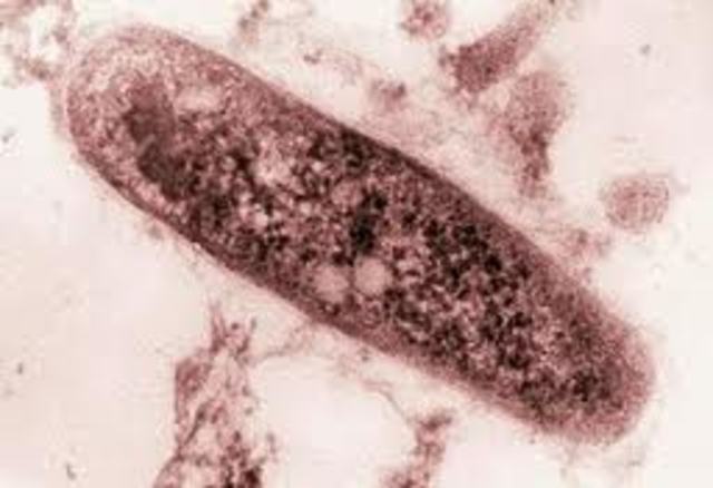 Descubrimiento de Bacilo de Tuberculosis
