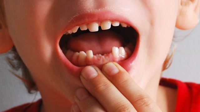 Me salió primer diente