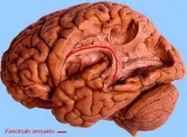 PATOLOGÍAS DEL LENGUAJE