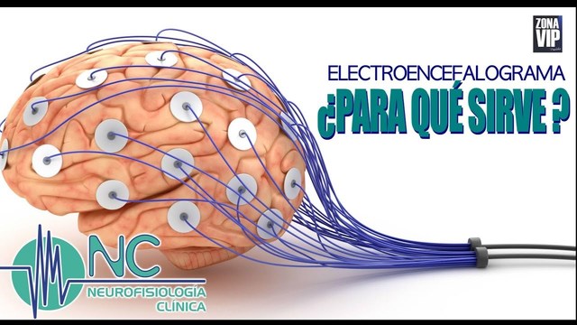 Técnica de Neuroimagen ELectroencefalografia