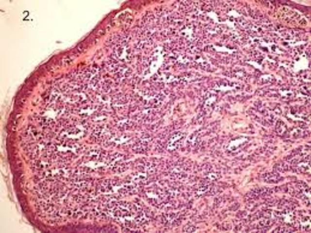 Surgimiento del sistema nervioso