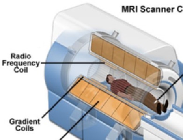 Resonancia Magnética (IRM ó TRM)
