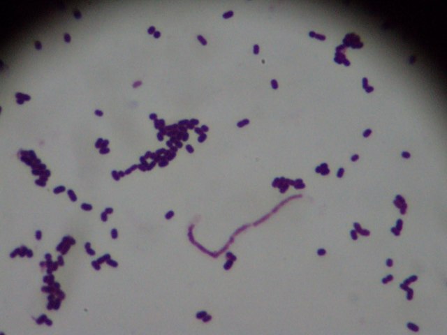 Bacterias en la leche