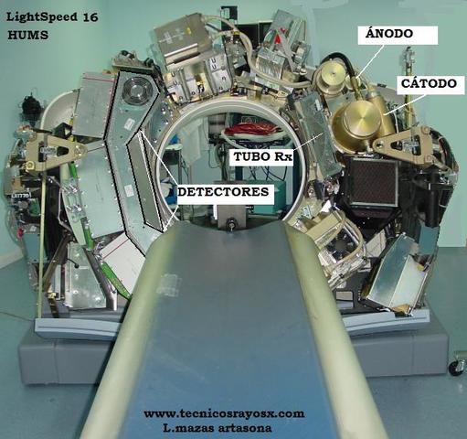 Uso de tomografía computarizada