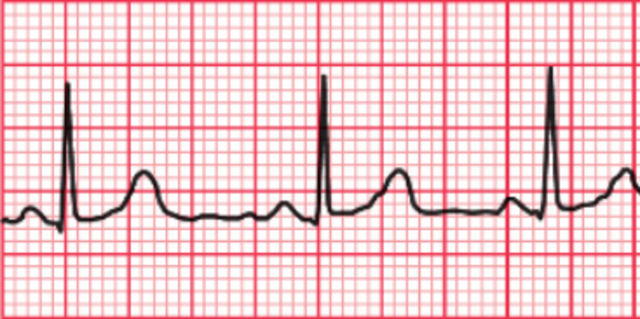 Electrocardiografo