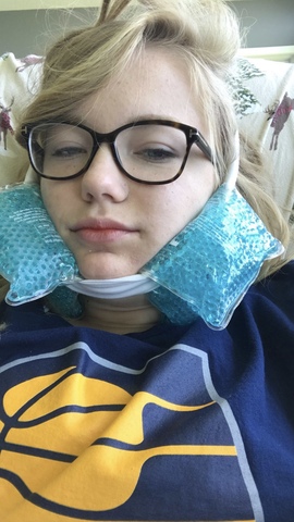 Wisdom teeth removal