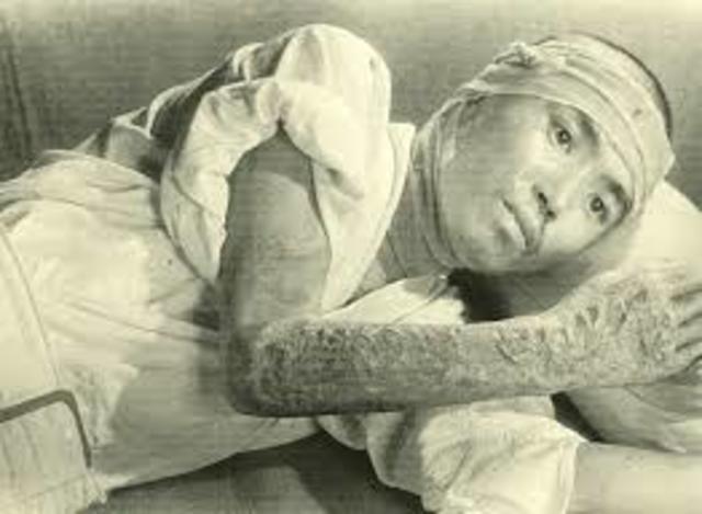 Surrender of Japan: Bombing of Hiroshima and Nagasaki