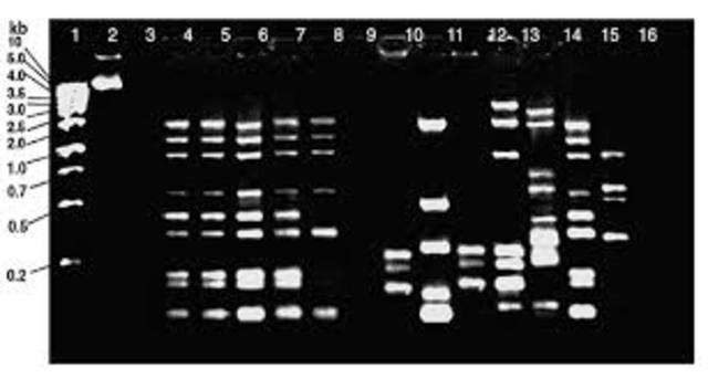 se utiliza por primera vez la "huella genética" en una investigación judicial en Gran Bretaña