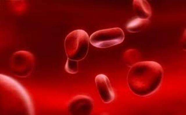 Transfusión de Sangre