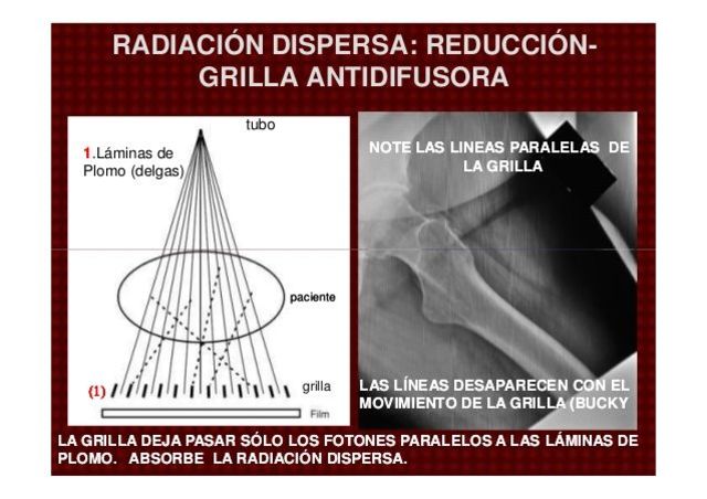 Rejilla antidifusora