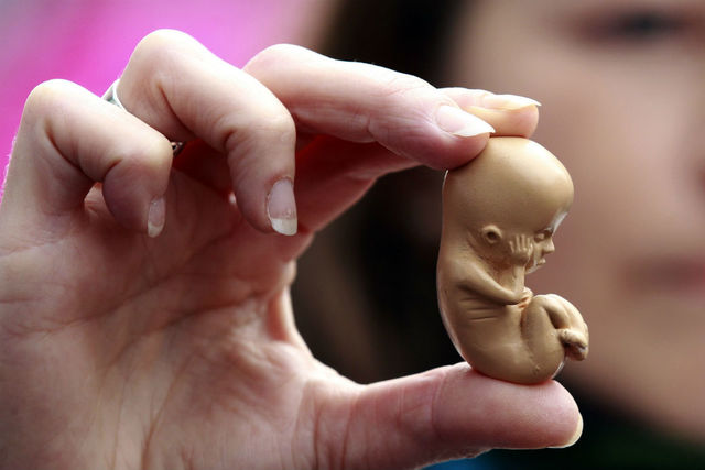 ABORTO EN ESTADOS UNIDOS