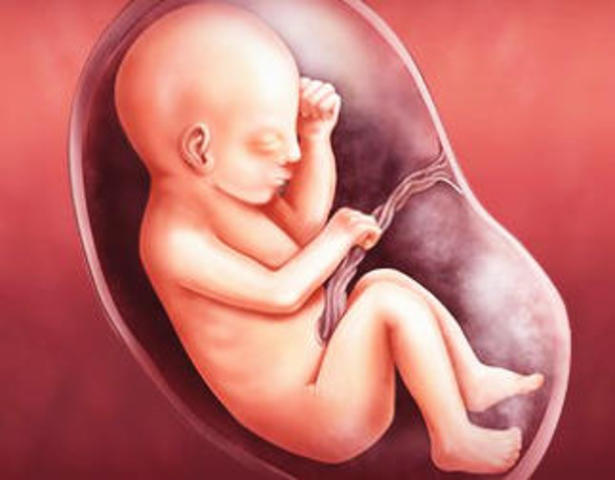 Vigésimo novena semana