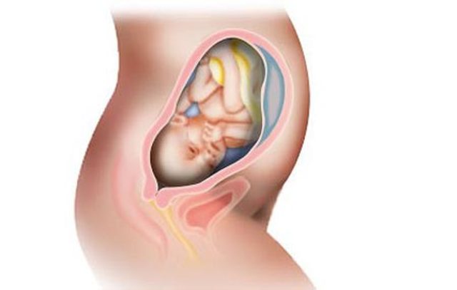 Trigésima primera semana