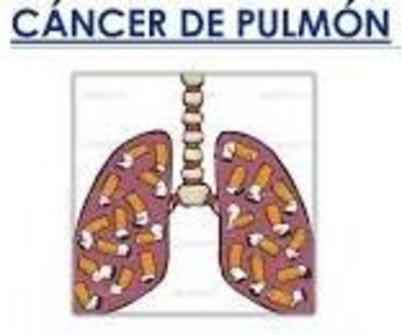 Tabaco-Cáncer