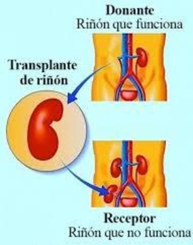 Transplante