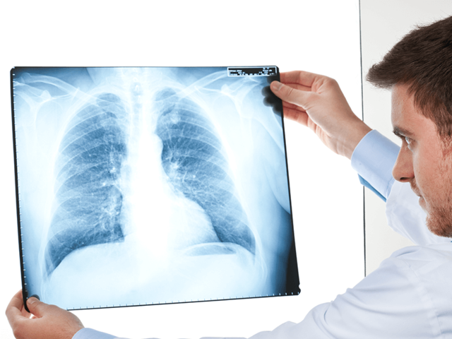 Se descubre los rayos x