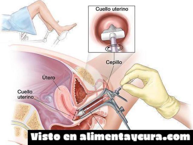 Citologia vaginal