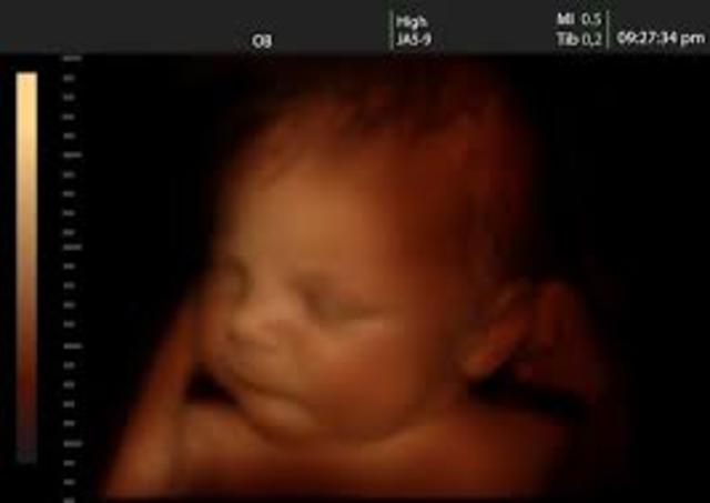 semana 16 de embarazo