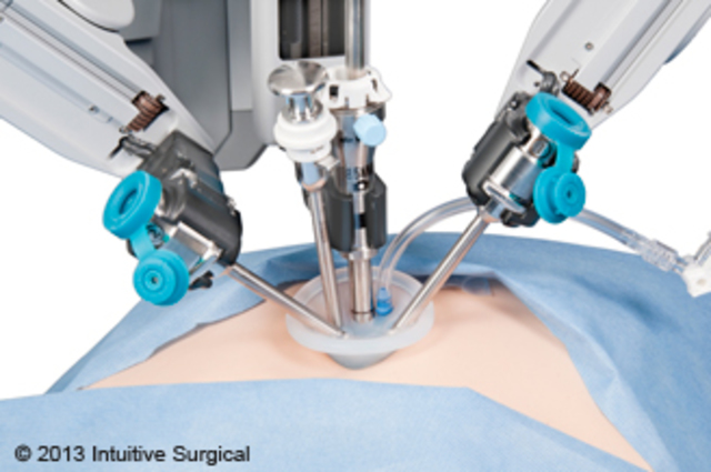 Telerobotic Surgery