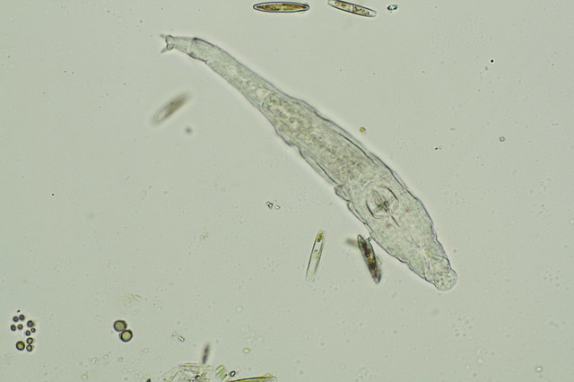 Primera observació de protozous y rotífers