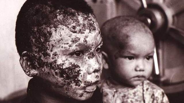 Convención sobre la prohibición del Desarrollo, la Producción y sobre el Almacenamiento de Armas Bacteriológicas (Biológicas) y Toxínicas y sobre su destrucción