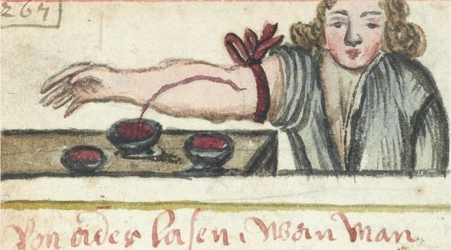Egyptians used bloodletting to try to cure diseases.