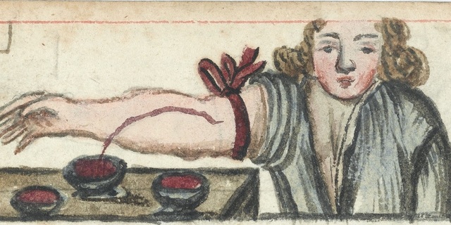 Bloodletting method