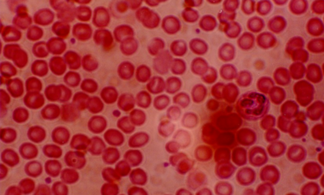 Anton Van Leeuwenhoek viewed blood cells under a microscope