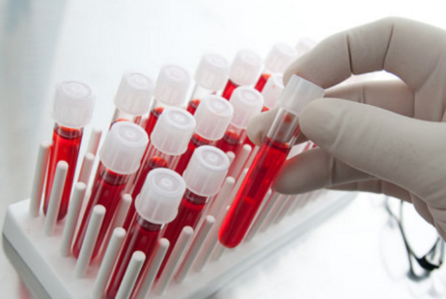 Scientists began developing blood-screening tests for infectious diseases