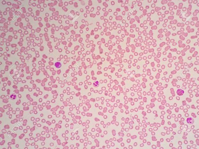 Anton Van Leeuwenhoek