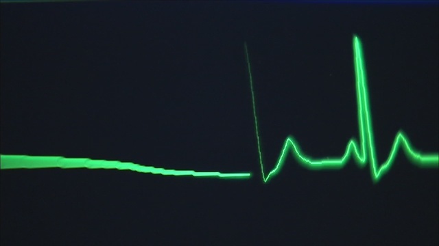 Near Death Experience