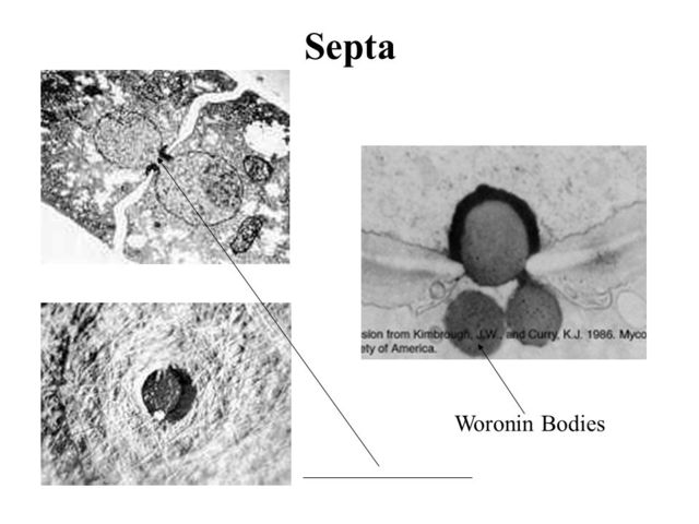 Cuerpos de Woronin(Ascomicetos)