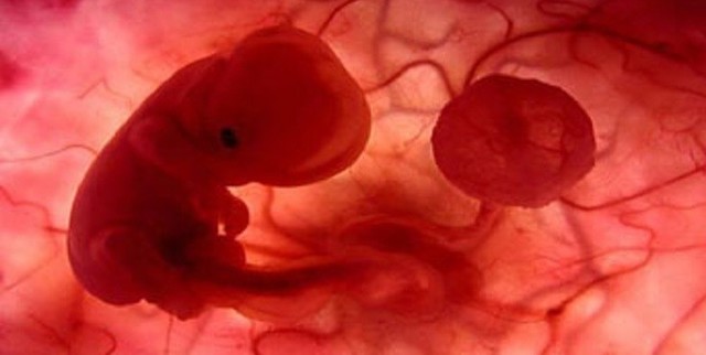 Código Internacional de la Asociación Medica de Oslo