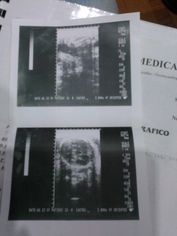 Etapa prenatal ( 9 meses de gestación en el vientre)