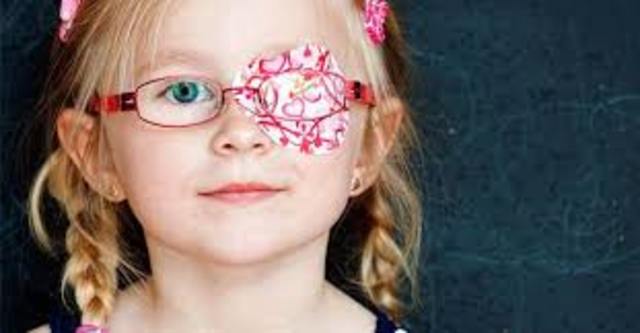 TRATAMIENTO DE LA AMBLIOPÍA.